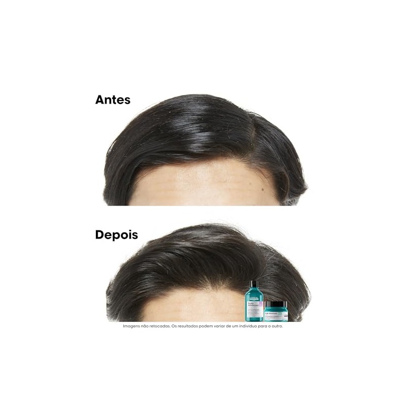 L'Oréal Professionnel |Scalp Advanced |Anti-sensibilidad