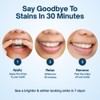 MySweetSmile PAP Teeth Whitening Strips - Enamel-Safe, Sensitivity-Free Formula -
