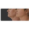 Crema Gel A, Hialuronico Reafirma Cuello Disminuye Papada 40