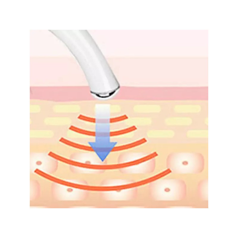 눈꺼풀처짐 눈꼬리올리기 눈꺼풀처짐리프팅 짝눈 교정 [필수/화이트] Eyelid Droop Lifting, Eyelash