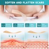 Silicone Scar Sheets, Silicone Scar Tape(1.8” x 157” Roll-4M), Scar