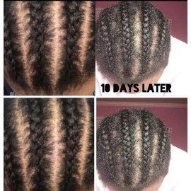 TC Beauty Anti-itch hair Growth Braid Oil, Itchy scalp, 30 ML by TC Beauty