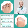 Welnove Hammer Toe Straightener Toe Corrector for Women - 8