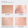 Magnetic Face Massager Micro Vibration Beauty Instrument Serum Importing Skin