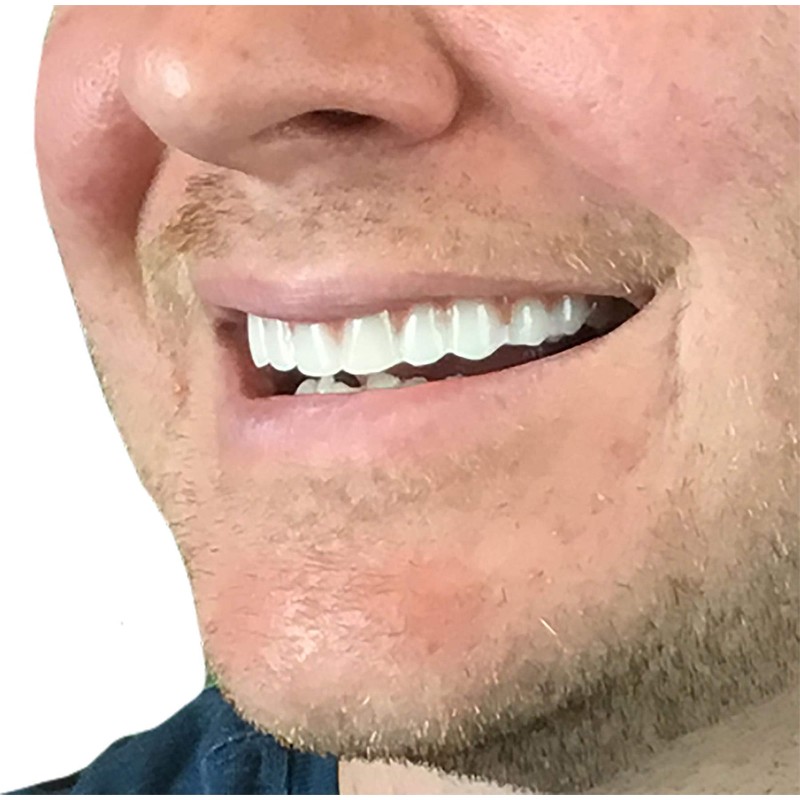Instant Smile Comfort Fit Flex - Bright Shade - Upper