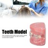 Demonstration Orthodontics Dental Model Disassembled Resin Teeth Model for Teaching