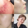 Kit De Viaje Riman Skincare Coreano - Rutina Completa