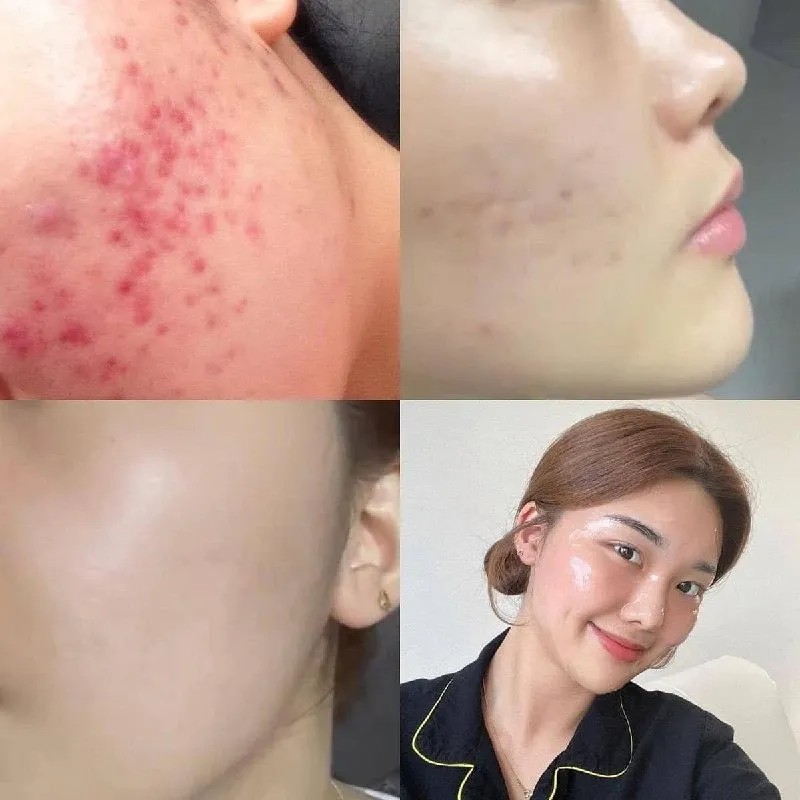 Kit De Viaje Riman Skincare Coreano - Rutina Completa