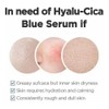 Skin1004 Madagascar Centella Hyalu-cica Blue Serum 50ml Todo Tipo De