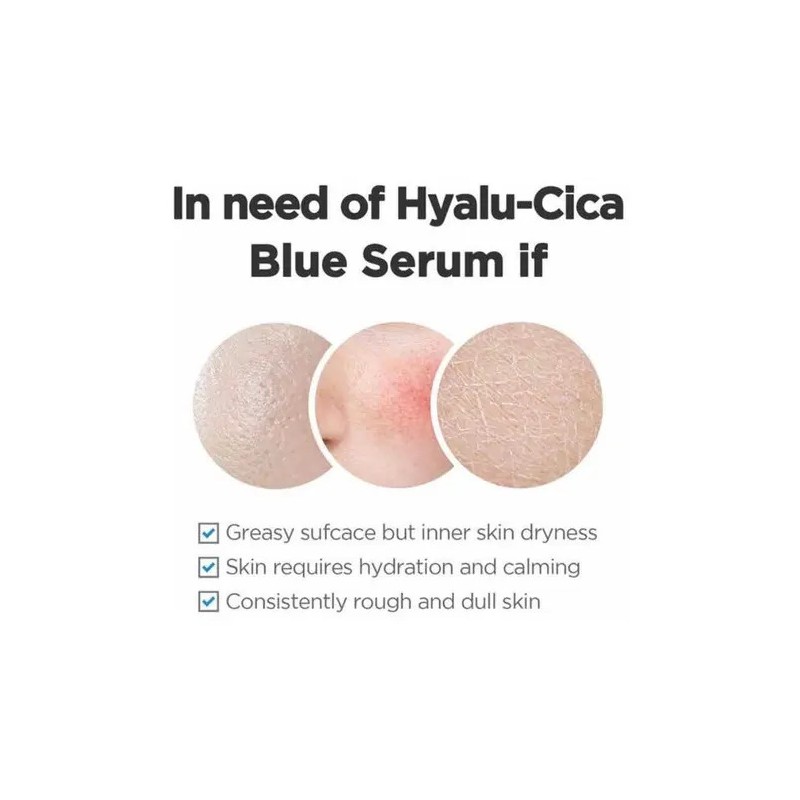 Skin1004 Madagascar Centella Hyalu-cica Blue Serum 50ml Todo Tipo De
