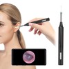 Ear Endoscope Smart Wireless WiFi Visual Earwax Removal with Camera