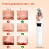 Limpiador De Poros Extractor De Puntos Negros Y Acné Facial