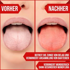 NEUMANN® Tongue Cleaner Stainless Steel – Pack of 2 for Adults and Children – Tongue Scraper Against Bad Breath