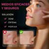 Parches Acne Con Micropuntos Granos,barros,día Y Noche Acneica Día/noche