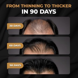 SPARTAN™ Root Activator Conditioner For Men - Hair Growth Conditioner, Thickening Hair Moisturizer for Hair Loss and Thinning Hair