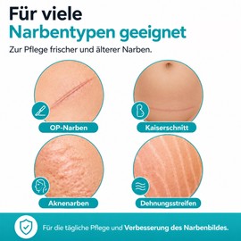 Zeitschild Scar Ointment Scar Cream I 30 ml Scar Care After Surgery without Emulsifiers, Caesarean Section, Acne Scars I OLT Barrier Technology, Hyaluron, Madecassoside