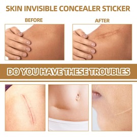 60 Parches de Silicona para Cubrir Cicatrices Parche Invisible Corrector Pegatina Transpirable y Cómoda Marcas Nacimiento Manchas