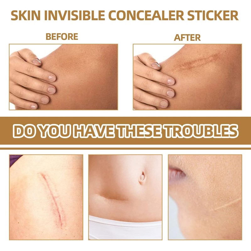 60 Parches de Silicona para Cubrir Cicatrices Parche Invisible Corrector