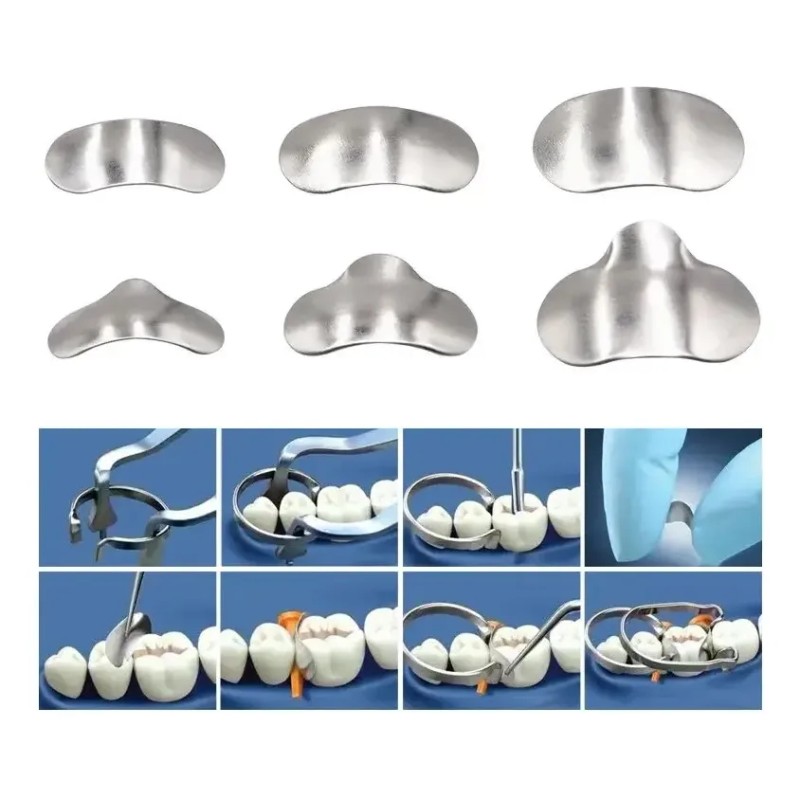 100 Piezas Banda Matriz Dental Contorneadas 2 Anillos Kit