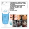 Acne Limpieza Facial Kit Quita Manchas Cara Barros Shelo Nab