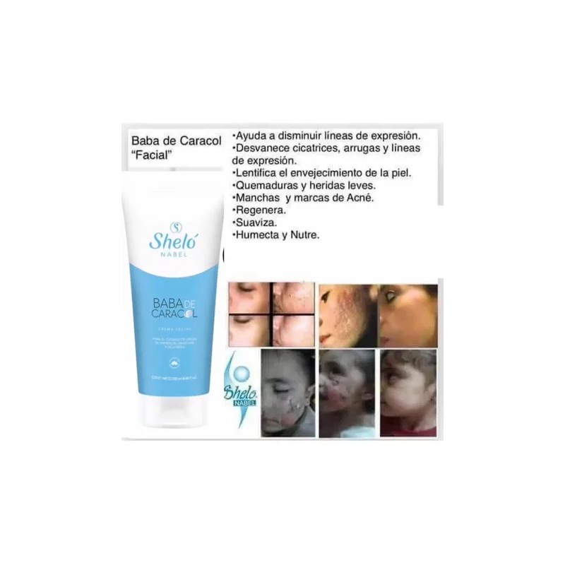 Acne Limpieza Facial Kit Quita Manchas Cara Barros Shelo Nab