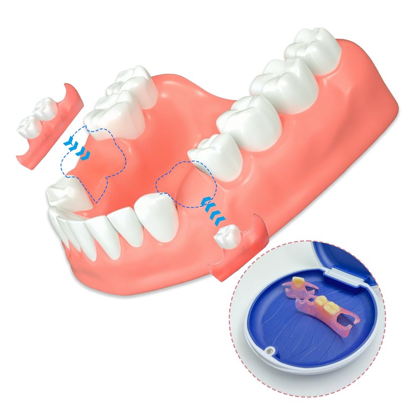 Miraila Custom Denture 3 Part Denture Denture for Denture Teeth