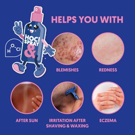 ANDbeauty HOCl Gesichtsspray – beruhigender Skin Toner mit hypochloriger Säure – erfrischendes & feuchtigkeitsspendendes Gesichtswasser für sensible Haut – alkoholfrei – 100ml