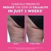 FIRMx Tight & Toned Cellulite Treatment