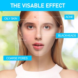 Turmeric Kojic Acid Cleansing Pads, Turmeric Kojic Pads, Turmeric Kojic Acid Pads for Exfoliating, Turmeric Exfoliating Face Pads for Dark Spots, Deep Cleansing (60 Pads)