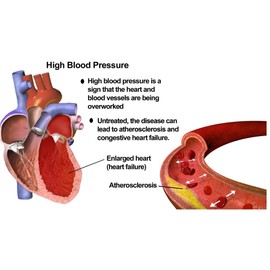 Pressure Guard - The Complete All-Natural Hypertension Supplement to Support Healthy Blood Pressure Level with a Unique Herbal Formulation. 180 Vegan Capsules, Proudly Made in The USA.