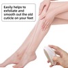 3-Piece Egg-Shaped Foot Files, Exfoliating Foot Rub, Manual Foot Scrub,