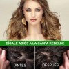 Aliver - Batana Oil - 60 Ml - Cuidado Cabello