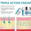Dark Spot Remover for Face&Body,Dark Spot Correcting Cream,Dar/k Sp/ot Remover,Pigmentation