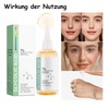 Soleneva Glycolic Acid 7% Toning Solution, Glykolsäure Toner für Gesicht,