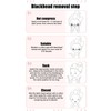 Blackhead Remover Blackhead Absorption Instrument Electric Pore Vacuum Machine Facial