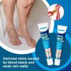 Crema Tratamiento Profesional Varices Venas Piernas Alivia