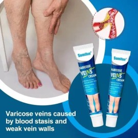 Crema Tratamiento Profesional Varices Venas Piernas Alivia