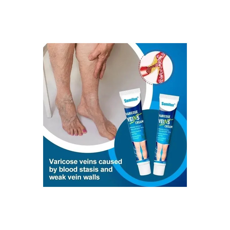 Crema Tratamiento Profesional Varices Venas Piernas Alivia