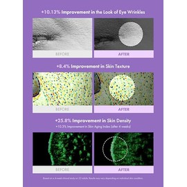 MAXCLINIC Exosome PDRN - Ampolla reparadora de suero facial hidratante, revitalizante y reafirmante con salmón y PDRN a base de plantas para...       