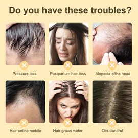 Bisienya Ginger Plant Extract Anti-Hair Loss Hair Shampoo, Ginger Extract Shampoo, Plant Extract Oil Control Anti-Dandruff Shampoo for Hair Growth, Ginger Anti Hair Loss Shampoo for Women & Men