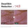 Dr.G- Cuidado peeling suave sin irritación de la piel.