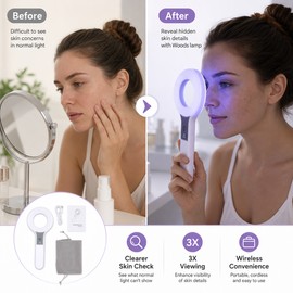 Skin Analysis Magnifier for Beauty Care – Rechargeable 3X Wood Lamp for Home Salon Spa Use