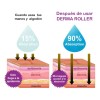 2 Piezas Dermaroller 0.25 Mm Barba Facial Cabello Ra01 Am7