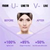Tratamiento Crema Elimina Papada Moldea El Rostro No Serum Todo