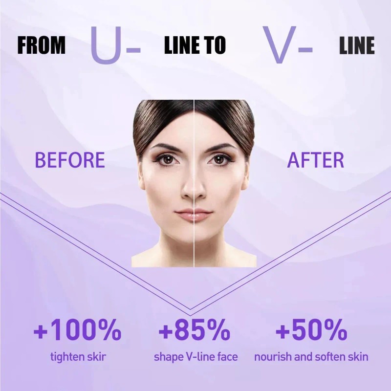 Tratamiento Crema Elimina Papada Moldea El Rostro No Serum Todo