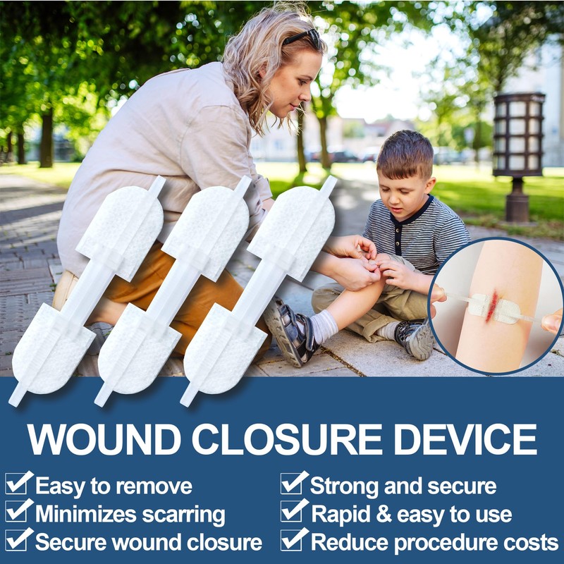 Wound Closure Strips - Emergency Laceration Closure Kit to Repair