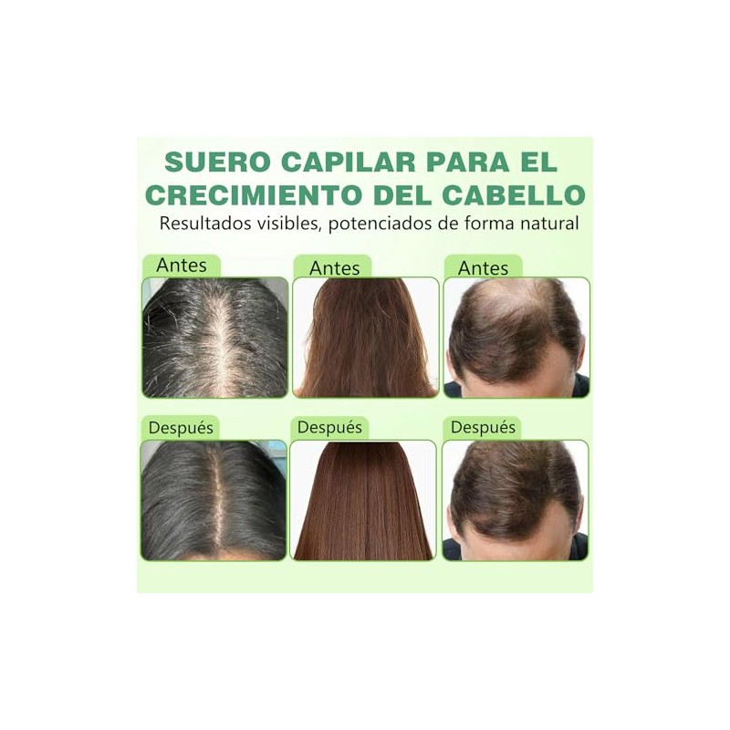 Hair Treatment Seru, Deja el Cabello Más Suave y Grueso