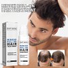 Unbranded Re:act Minoxi Roll-on Hair Treatment Hair Growth Serum Hair