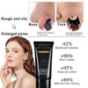 Blackhead Remover Activated Carbon Charcoal Face Mask Deep Cleansing Shrinks