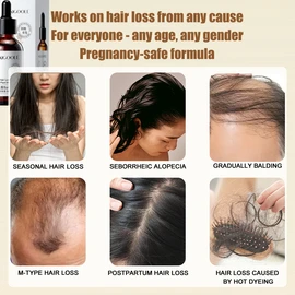 No Brand hair tonic hair growth serum 60ml Quick Hair Growth anti hair loss oil control repair fragile For both men and women